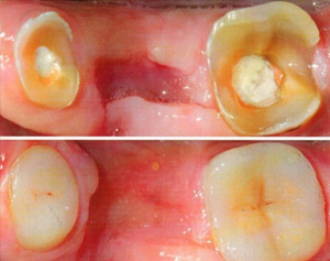 Biomimetic Dentistry - DR. BALU SOMAN’S DENTAL WORLD